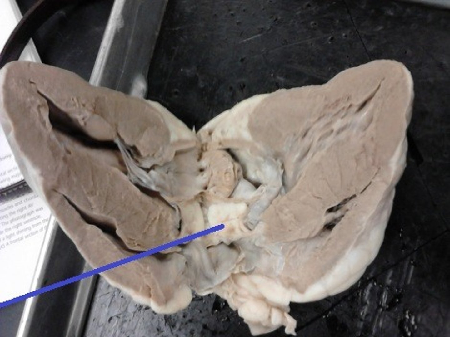 <p>Identify the valve.</p>