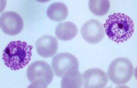 <p>This organism falls within phylum:</p><ul><li><p>Apicomplexa</p></li><li><p>Euglenozoa</p></li><li><p>Radiolaria</p></li><li><p>Chlorophyta</p></li></ul><p>And what is the organism?</p>