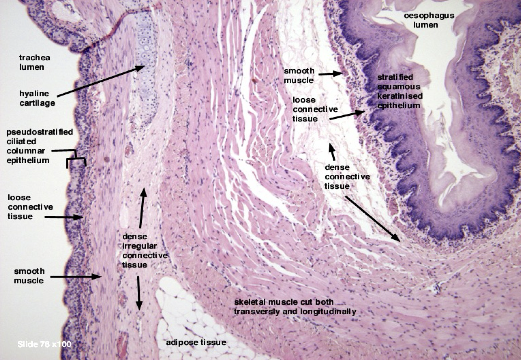 <p>Identify the structure</p>