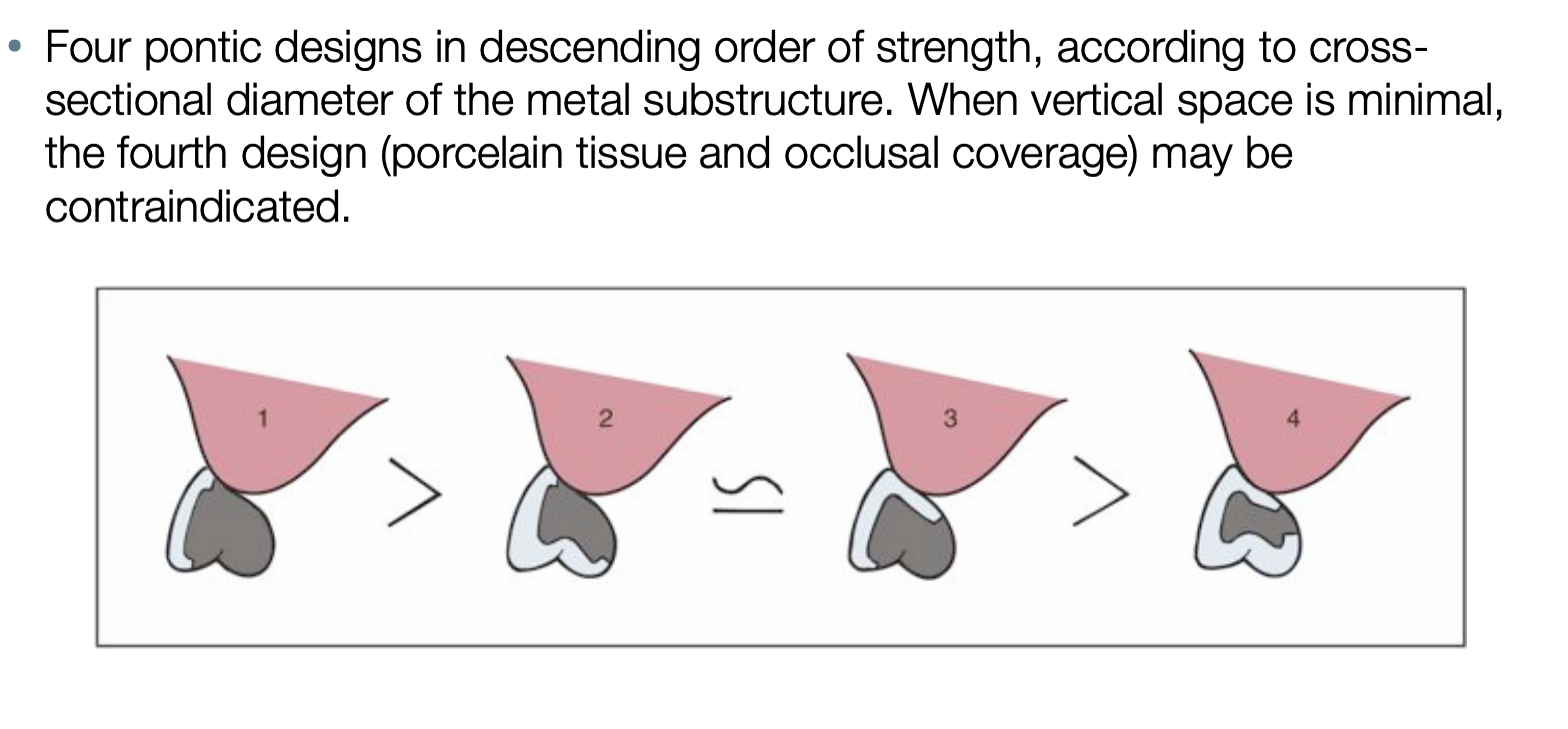 <p>4: when looking at the sectional diameter of the metal substructure, it is the weakest </p>