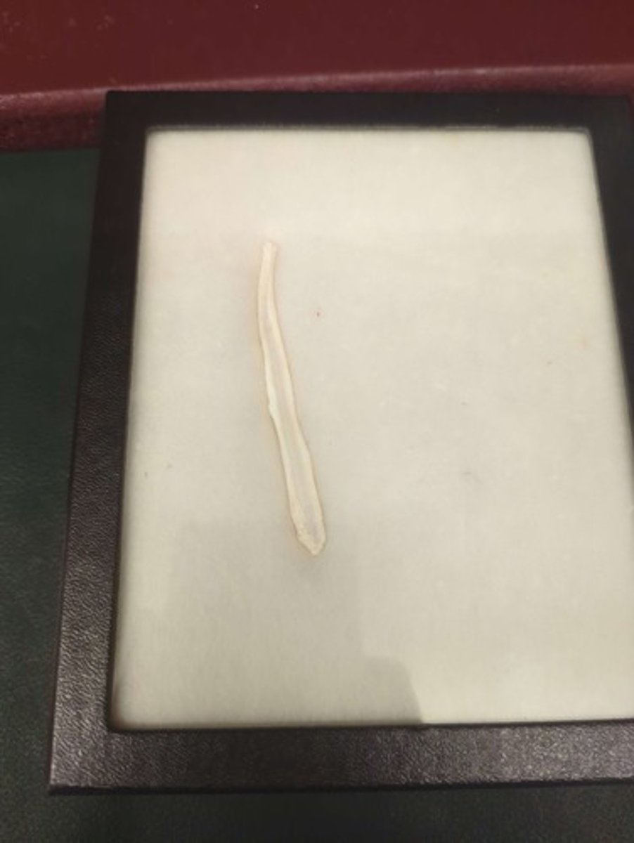 <p>What is this bone?</p>