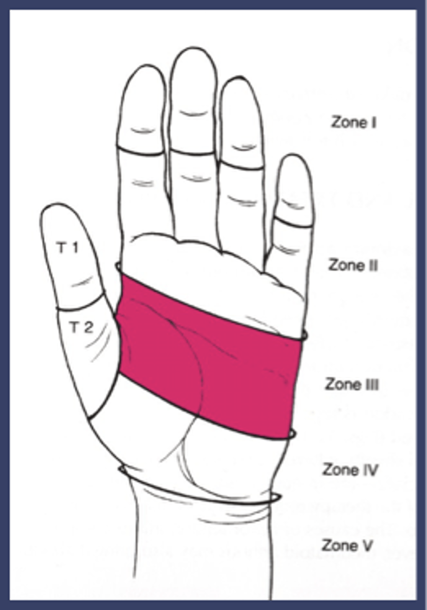 <p>palm of hand</p>