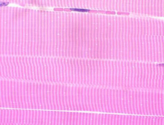 <p>Voluntary</p>