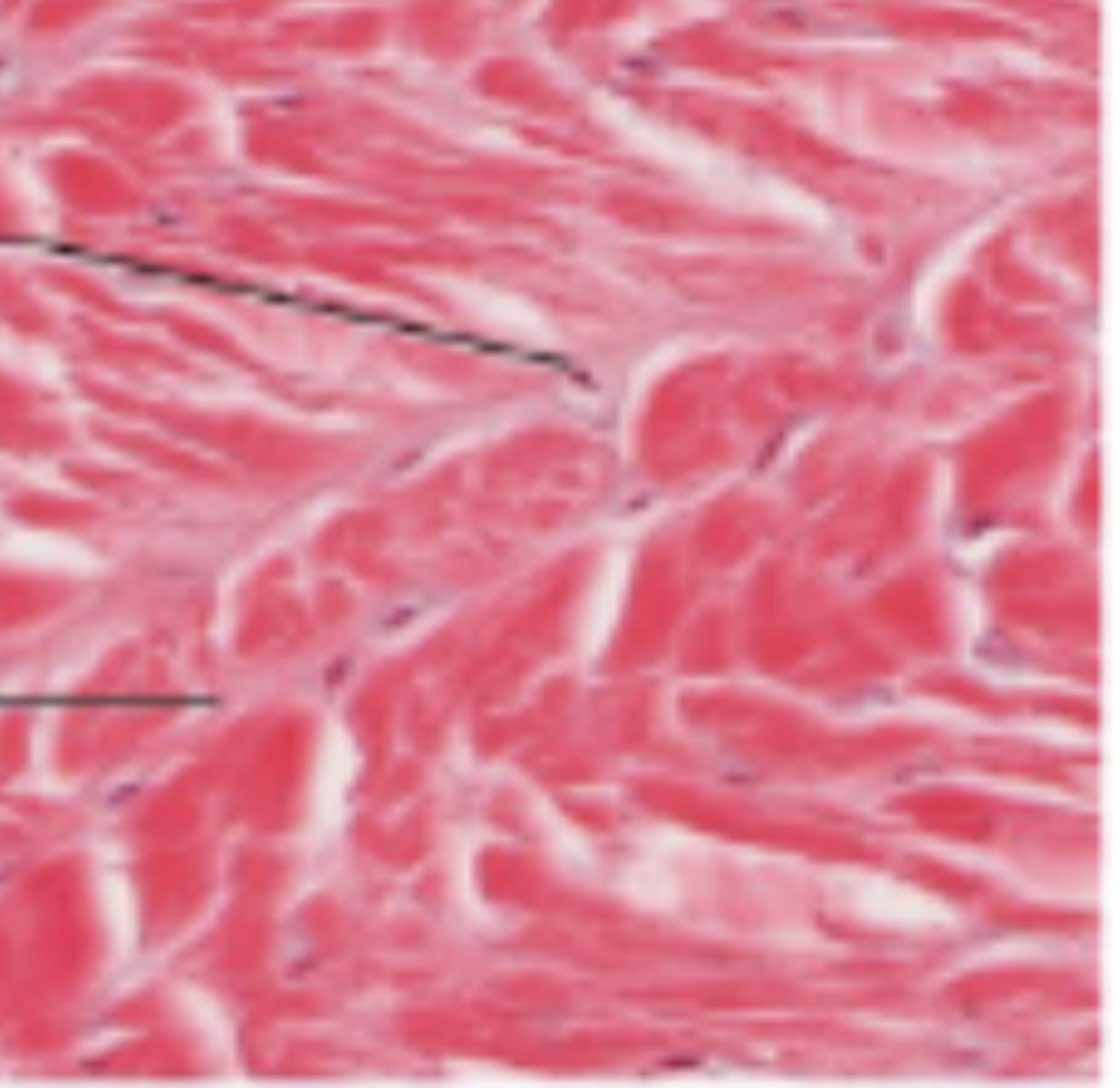 <p>Firm hyaline matrix but with more organized collagen fiber that can resist compressive force</p>
