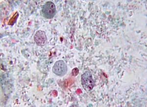 Endolimax nana cyst