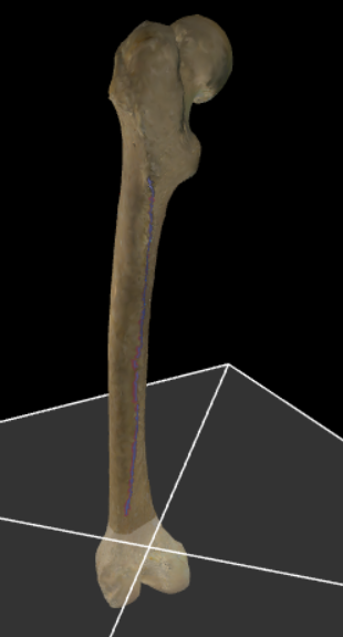 <p>De buitenlip van de linea aspera.</p>