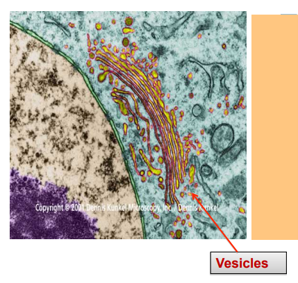 <p>Golgi body</p>