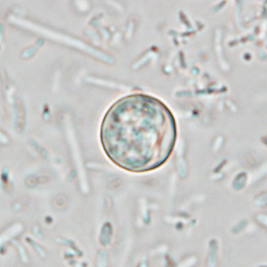 <p>Cyclospora (cayetanensis)</p><p>Cyst= 8-10 um</p><p></p>