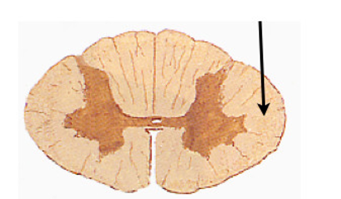 <p>located on each side of spinal cord between anterior and posterior columns</p>