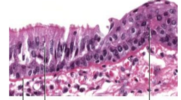 <p>Identify then define </p>