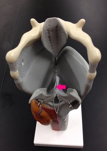 <p>space in-between two vocal folds</p>