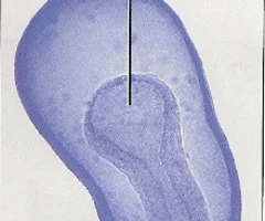 <p>the cavity formed by the endoderm; primitive gut; replaces the blastocoel and will eventually form the lumen of the digestive tract</p>