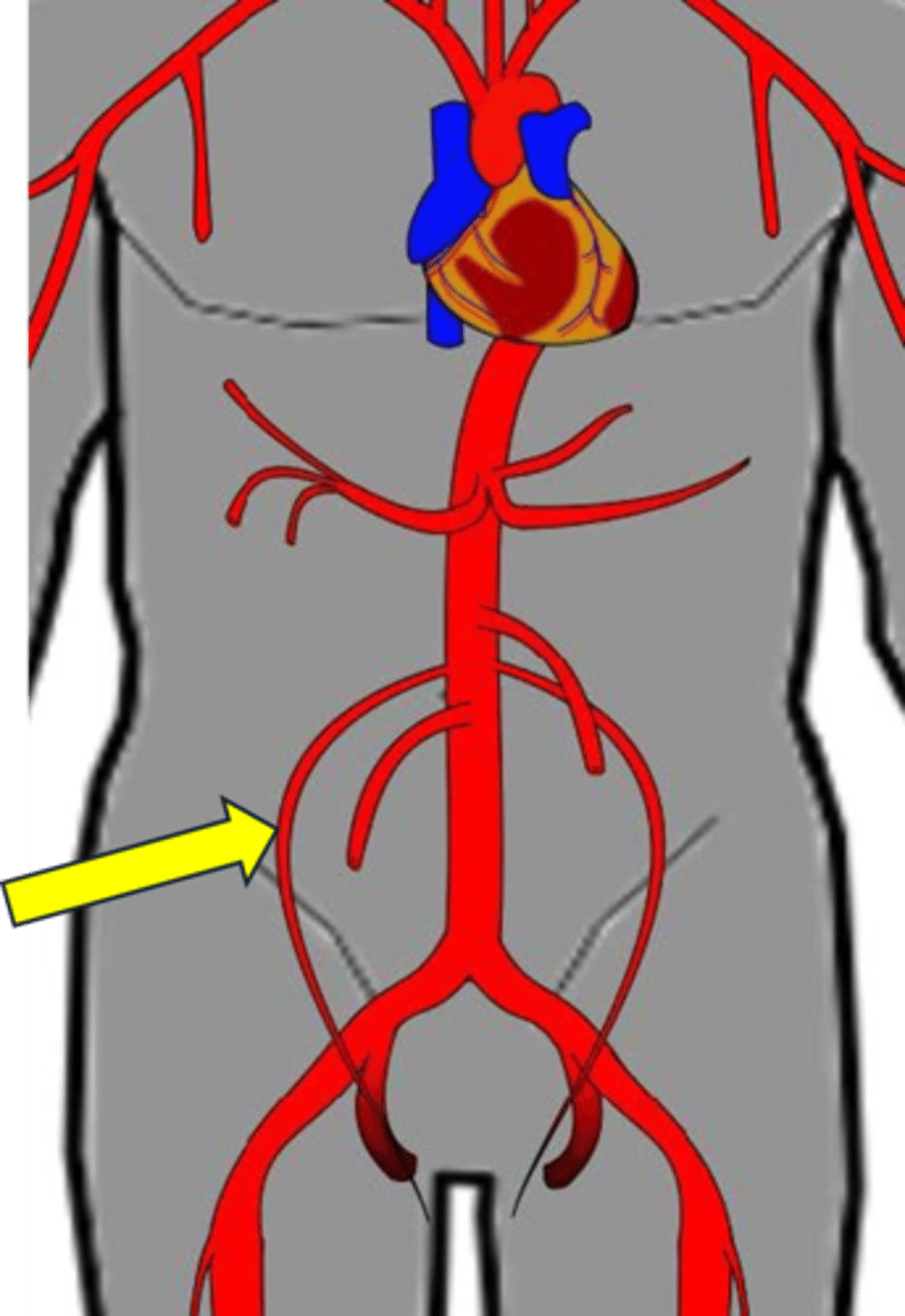 <p>Name the red vessel.</p>