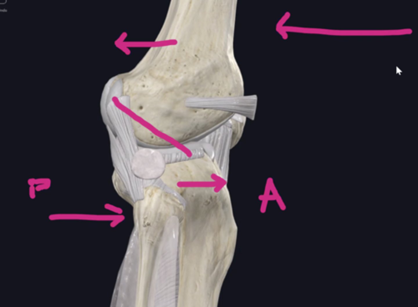 <p>ACL: Posterior translation of the femur</p><p>PCL: Posterior translation of the tibia</p>
