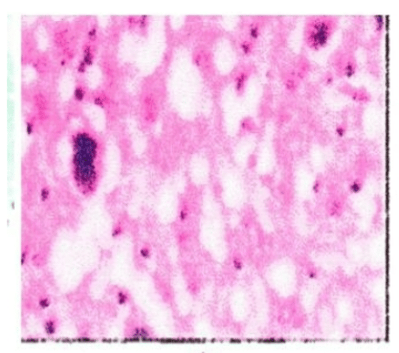 <p>the light spots show spongy areas where tissue has been destroyed</p><p>Elk brain tissue with chronic wasting disease. The gaps in the brain tissue are because of the abnormal folding with the prion tissues</p>