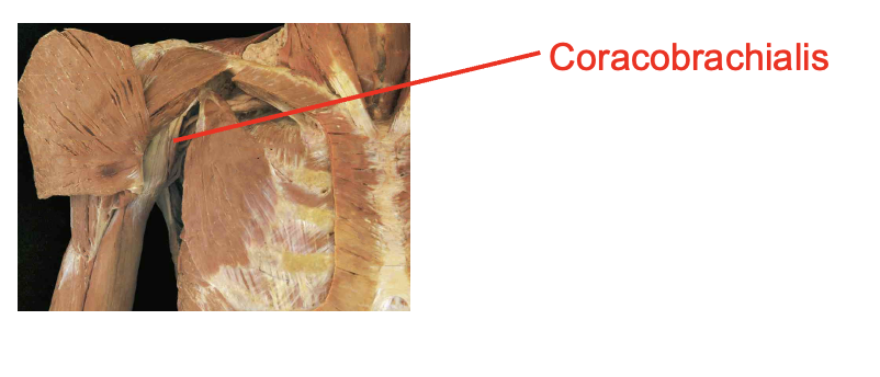 <p>Coracobrachialis</p><p>Origin</p><ul><li><p>coracoid process</p></li></ul><p>Insertion</p><ul><li><p>middle of medial humerous</p></li></ul><p></p><img src="https://knowt-user-attachments.s3.amazonaws.com/b8b26f92-f73d-4e51-aac8-2e9cacc284b2.png" data-width="100%" data-align="center"><p></p>