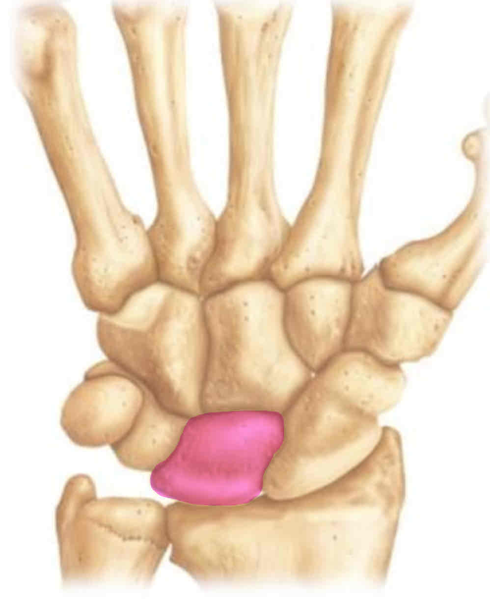term image