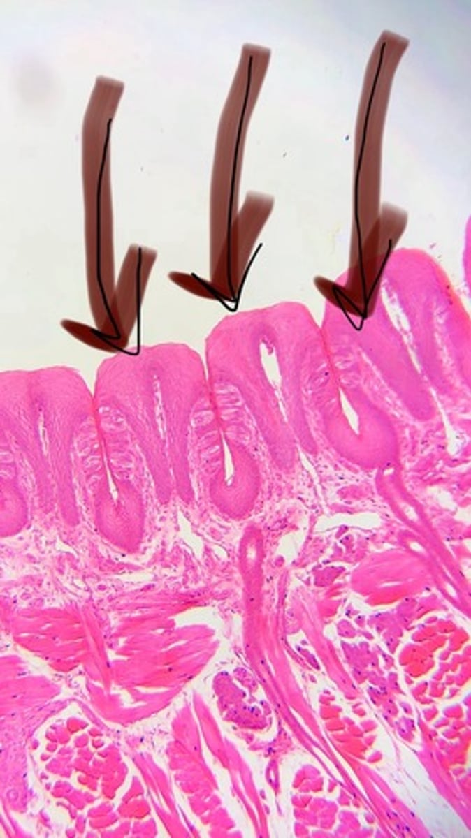 knowt flashcard image