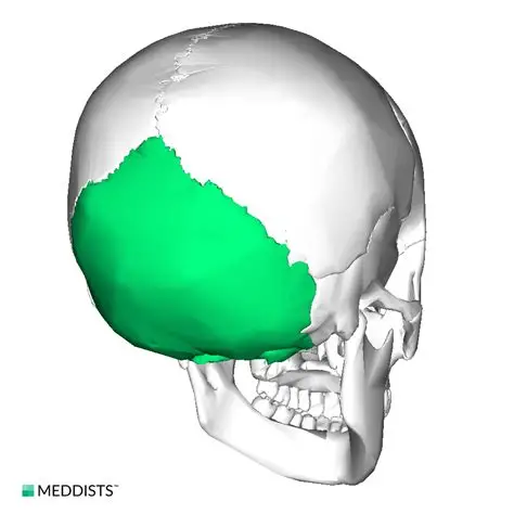 <p>Occipital bone!!!</p>