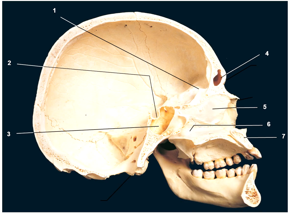 <p>Maxilla Bone</p>