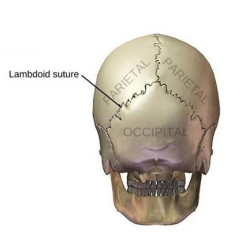<p>Occipital and parietal bones</p>