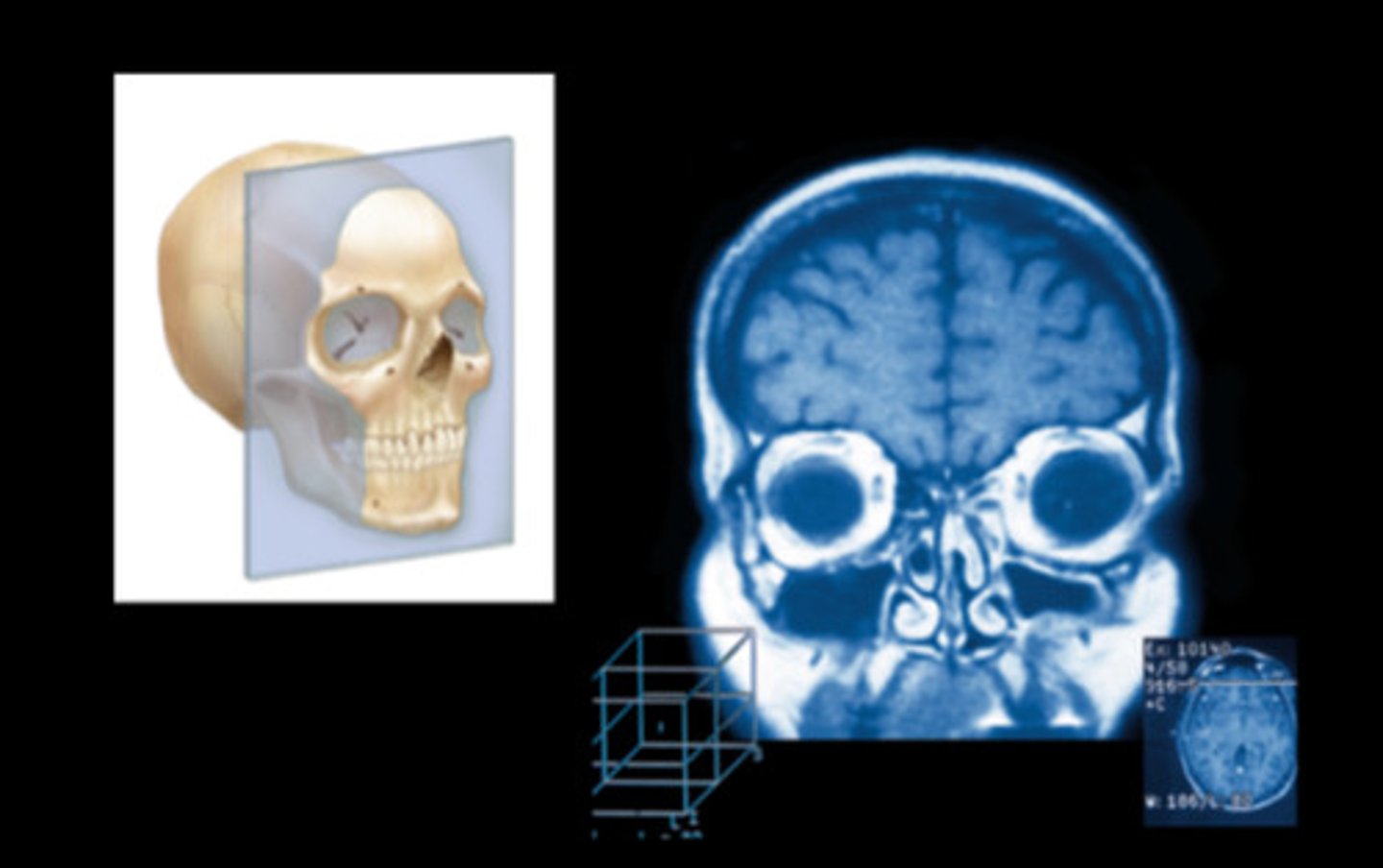 <p>Vertical Plane that divides body or organ into anterior and posterior parts (front and back)</p>