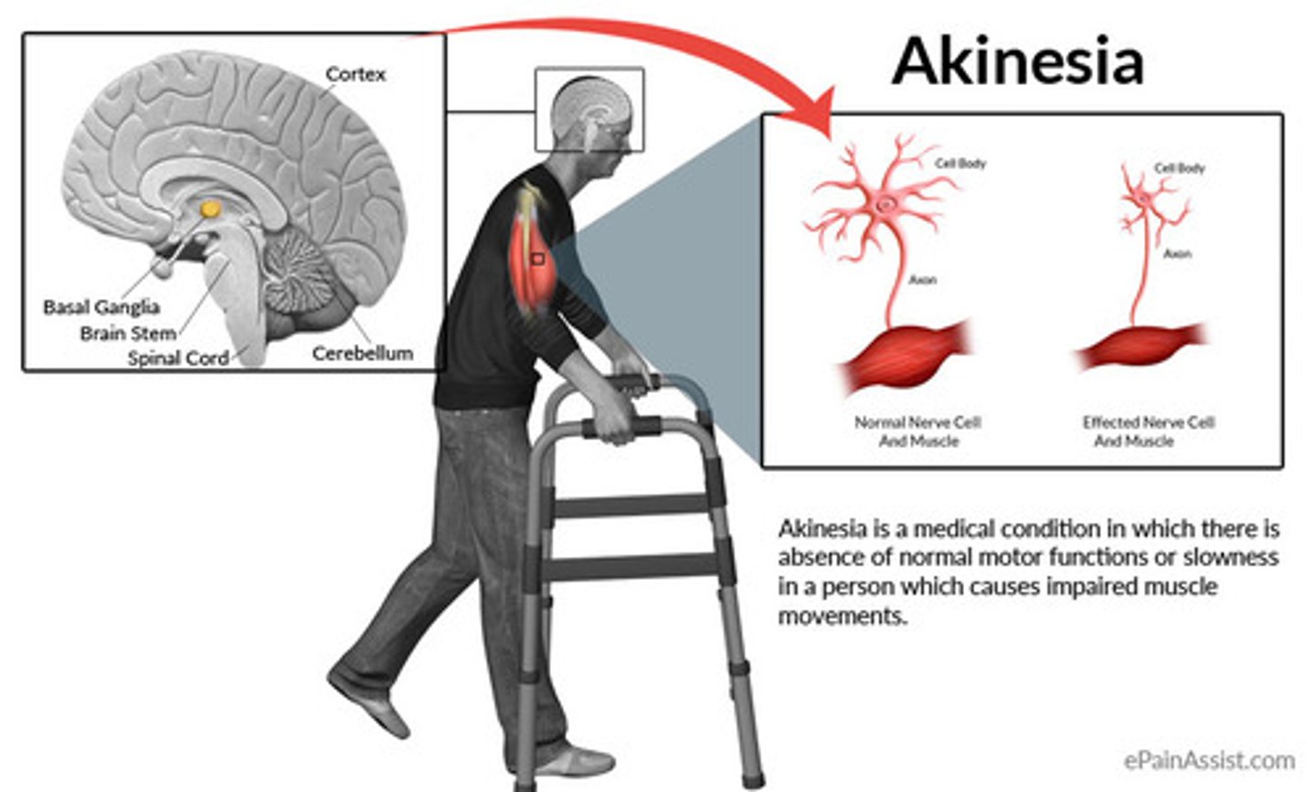<p>difficulty initiating movement voluntarily</p>