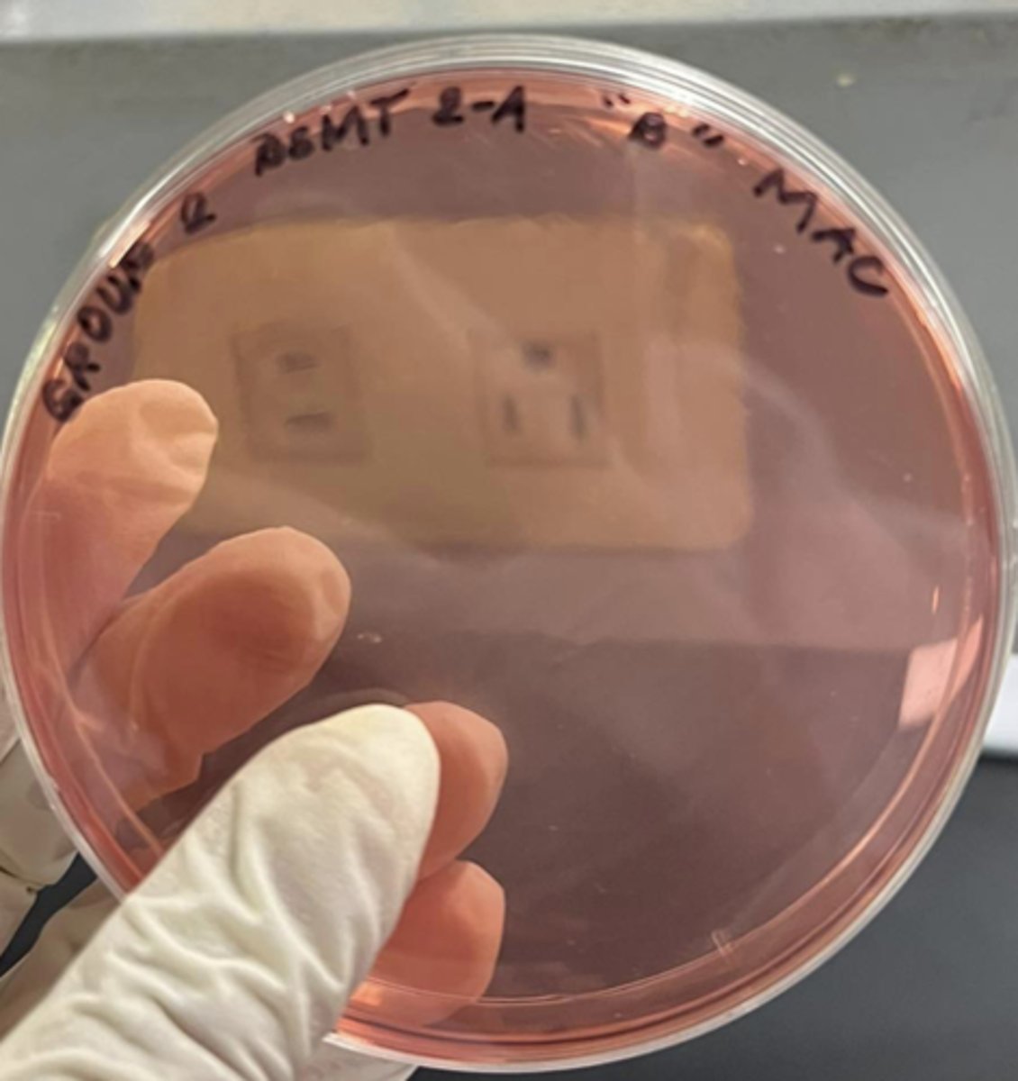 <p>Bile salts and Crystal Violet</p><p>-Inhibits G(+) growth</p>