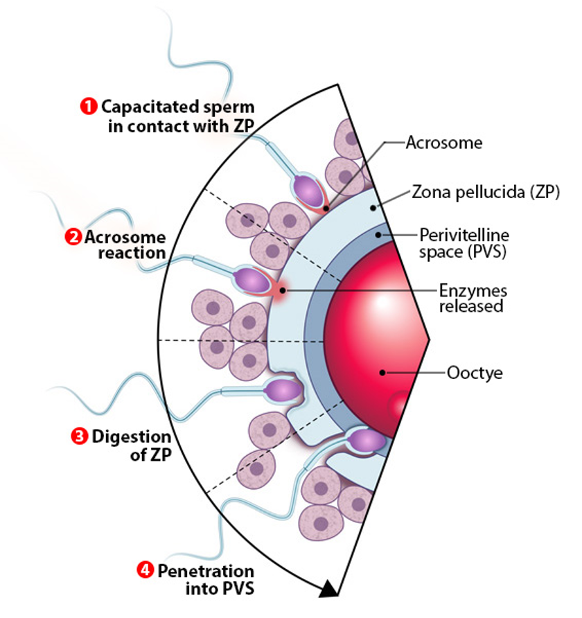 <ol><li><p>capacitated sperm <strong>contacts zona pellucida ZP</strong></p><ol><li><p>ZP= species-specific barrier</p></li><li><p>only sperm of same species can bind</p></li></ol></li><li><p>acrosome rxn</p><ol><li><p><strong>acrosome</strong> (enzyme sac on sperm head) <strong>ruptures</strong></p></li><li><p><strong>released proteases</strong> <strong>digest zona pellucida </strong>so sperm can pass thru</p></li><li><p>also <strong>rearranges sperm plasma membrane</strong> for fusion</p></li></ol></li><li><p>digestion of zona pellucida</p><ol><li><p>sperm uses enzymes + hyperactive movement to burrow through</p></li></ol></li><li><p><strong>penetration into perivitelline space PVS</strong></p><ol><li><p>sperm enters space btw ZP and oocyte</p></li><li><p>must find area w/ microvilli to bind and fuse</p></li></ol></li><li><p>sperm-oocyte membrane fusion</p><ol><li><p>triggers Ca2+ release in oocyte</p></li><li><p>activates oocyte→ completes meiosis II</p></li><li><p>blocks polyspermy, starts development</p></li></ol></li></ol><p></p>