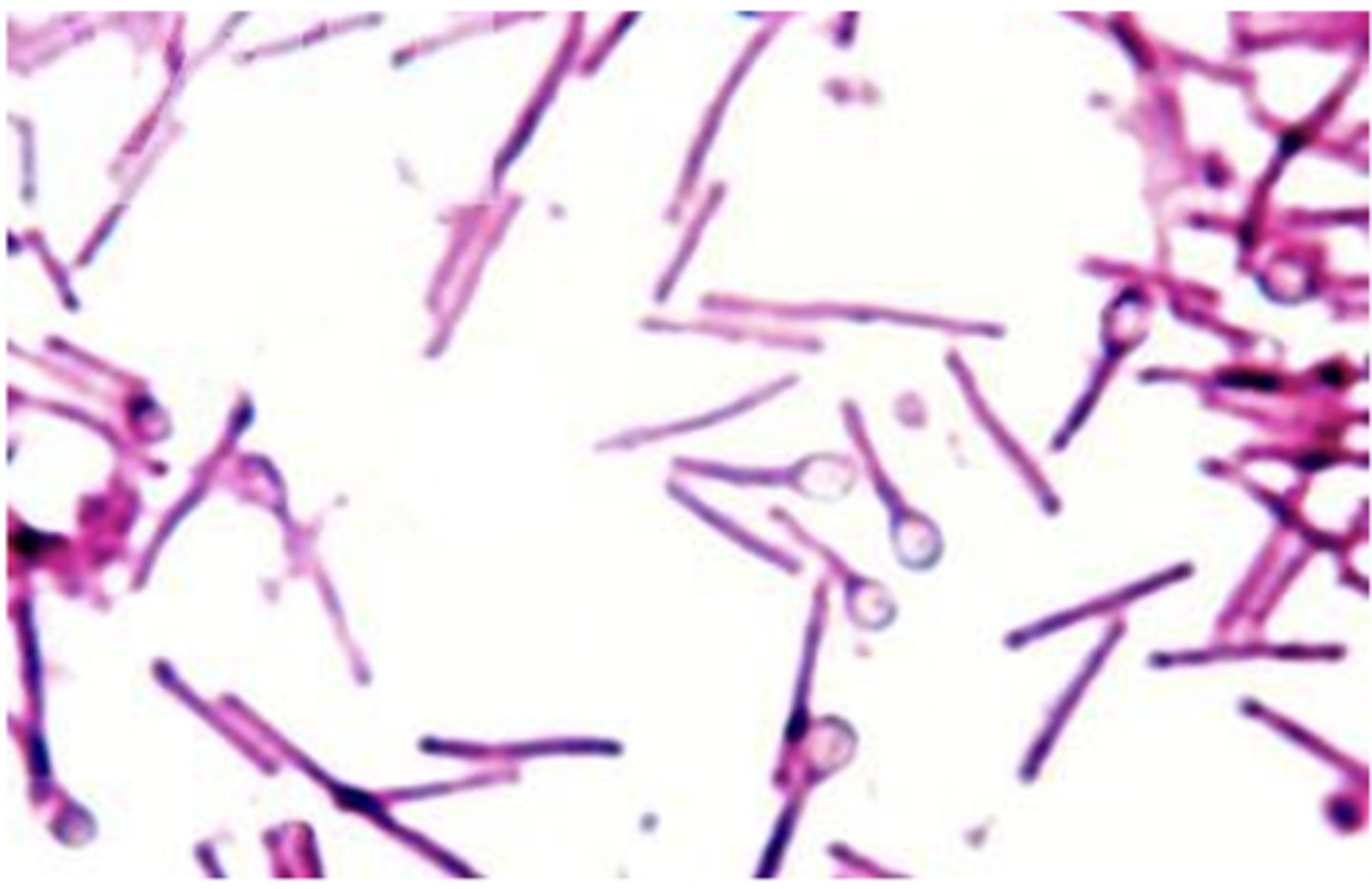 <p>Peptrostreptococcus</p><p>Propionibacterium acnes</p><p>Clostridiodes difficile</p><p>Clostridium spp</p>