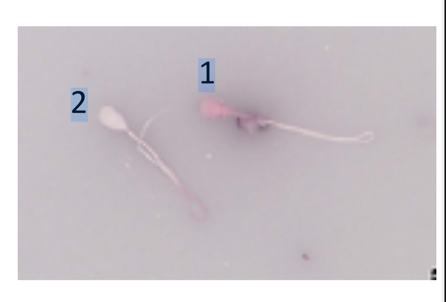 <p>1: Spz mort : absorbe la coloration éosine-nigrosine → rose (1).</p><p>2: Spz vivant → blanc (2), pas de coloration.</p>