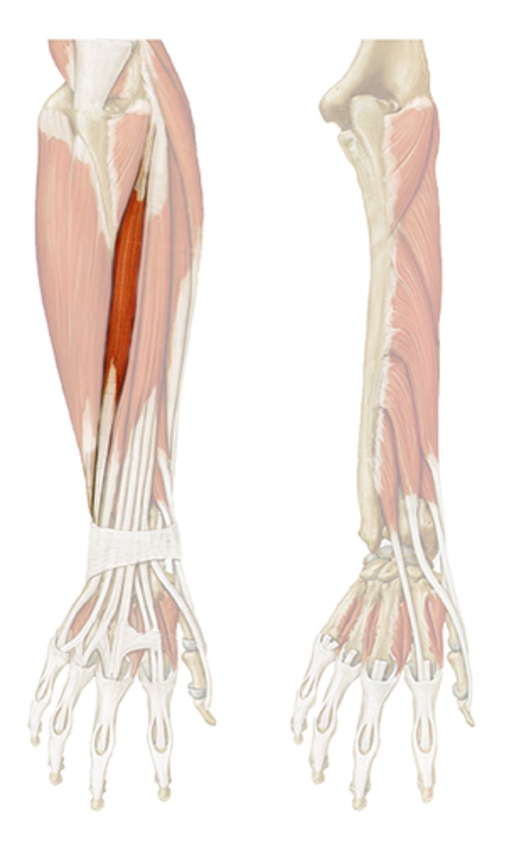 <p>O: Lateral humeral epicondyle</p><p>I: Base of metacarpal 5</p><p>A: Wrist extension</p>