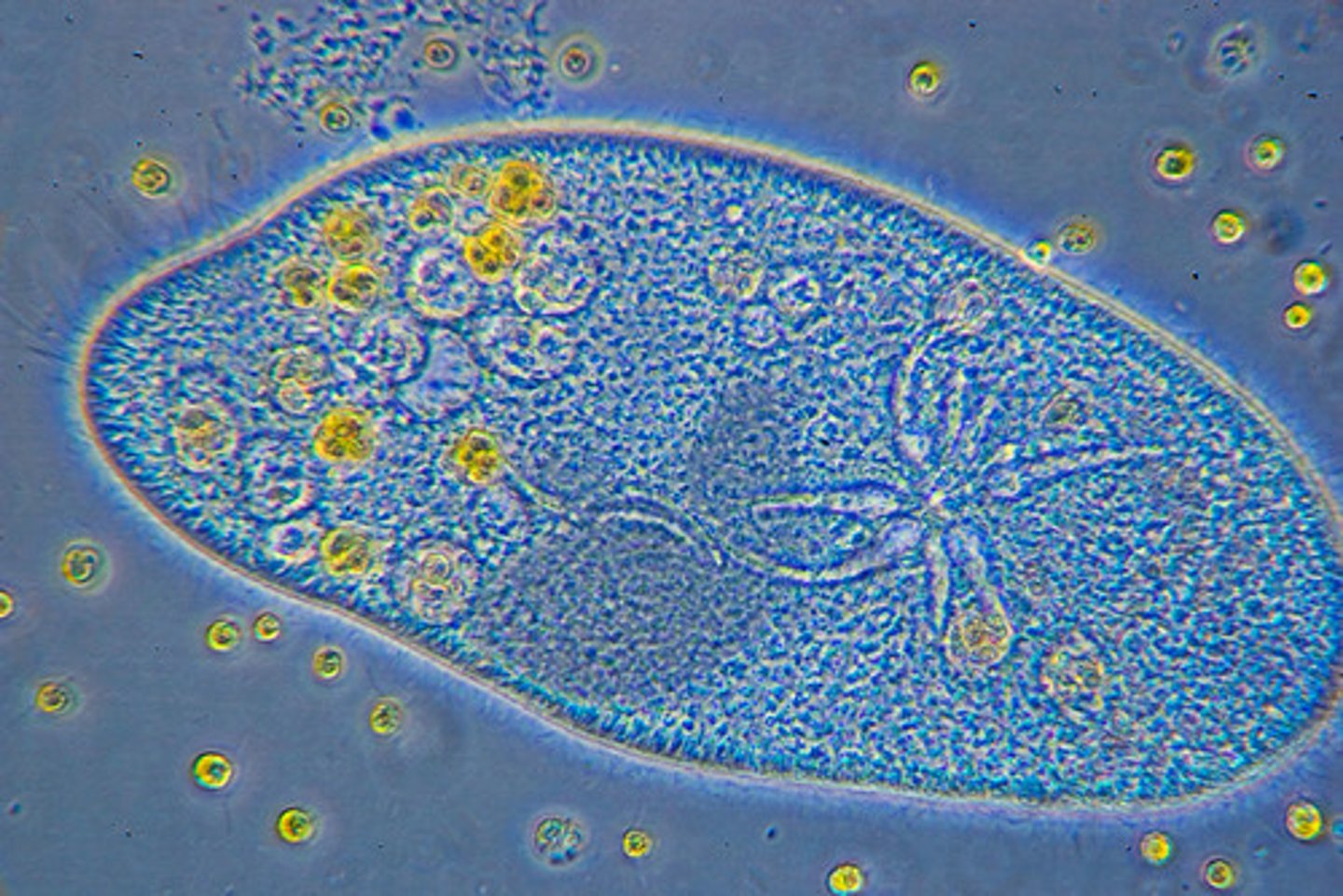 <p>Animal-like protists-amoeba, paramecium</p>