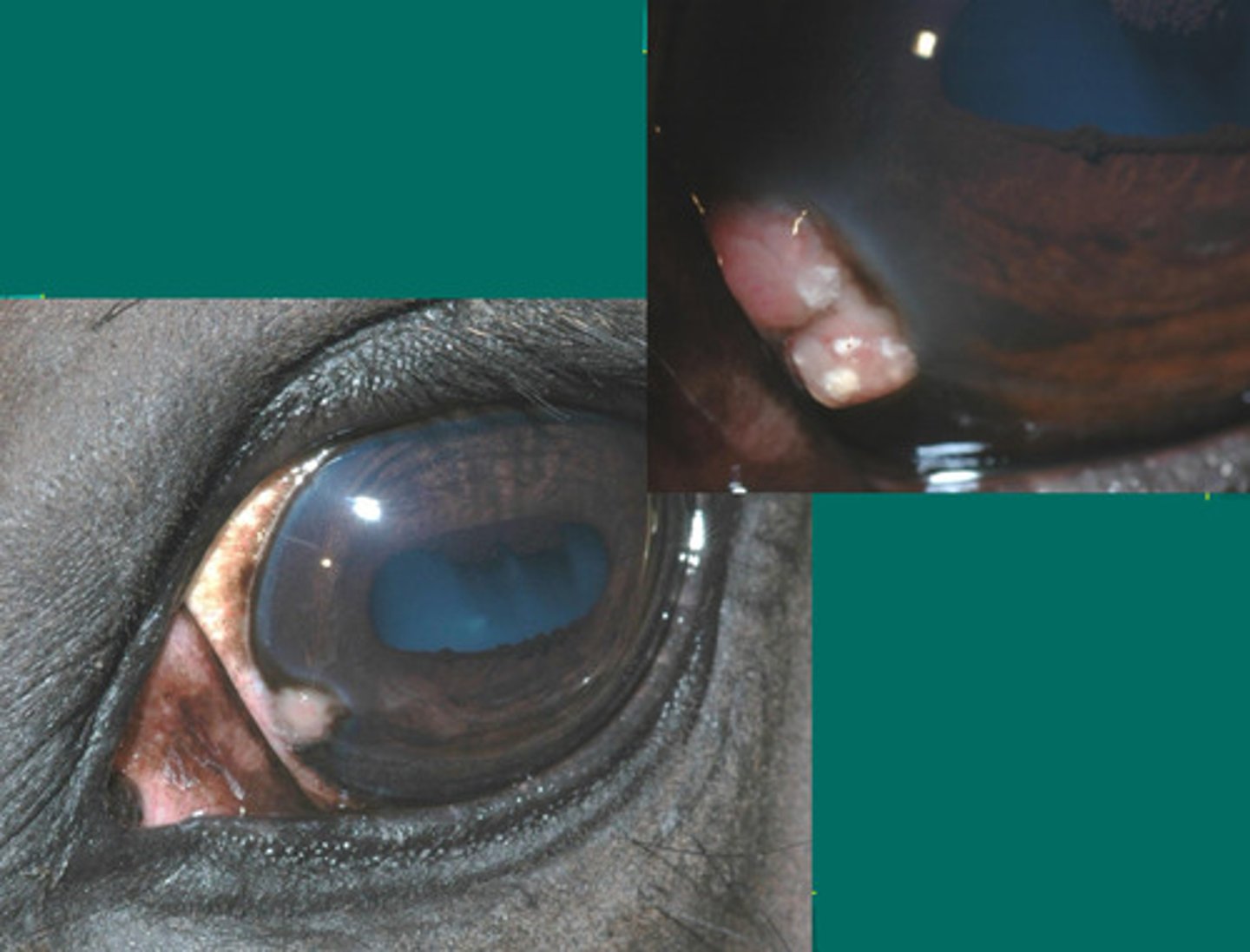 <p>What is happening in this eye, where there are raised limbal lesions resembling tumors which have sulfur type granules (yellow) visible?</p><p>a. immune mediated epithelial keratitis</p><p>b. chronic SUPERFICAL stromal immune mediated keratitis</p><p>c. chronic RECURRENT DEEP stromal immune mediated keratitis</p><p>d. eosinophilic keratitis</p><p>e. immune mediated endothelitis</p>