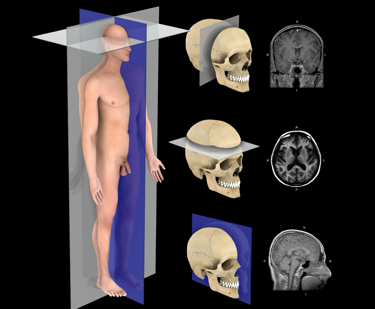 <p>-a vertical plane the passes parallel to the long axis of the body through the midline of the body, dividing it into right and left halves</p><p>-median plane is a specific example of a sagittal plane </p>