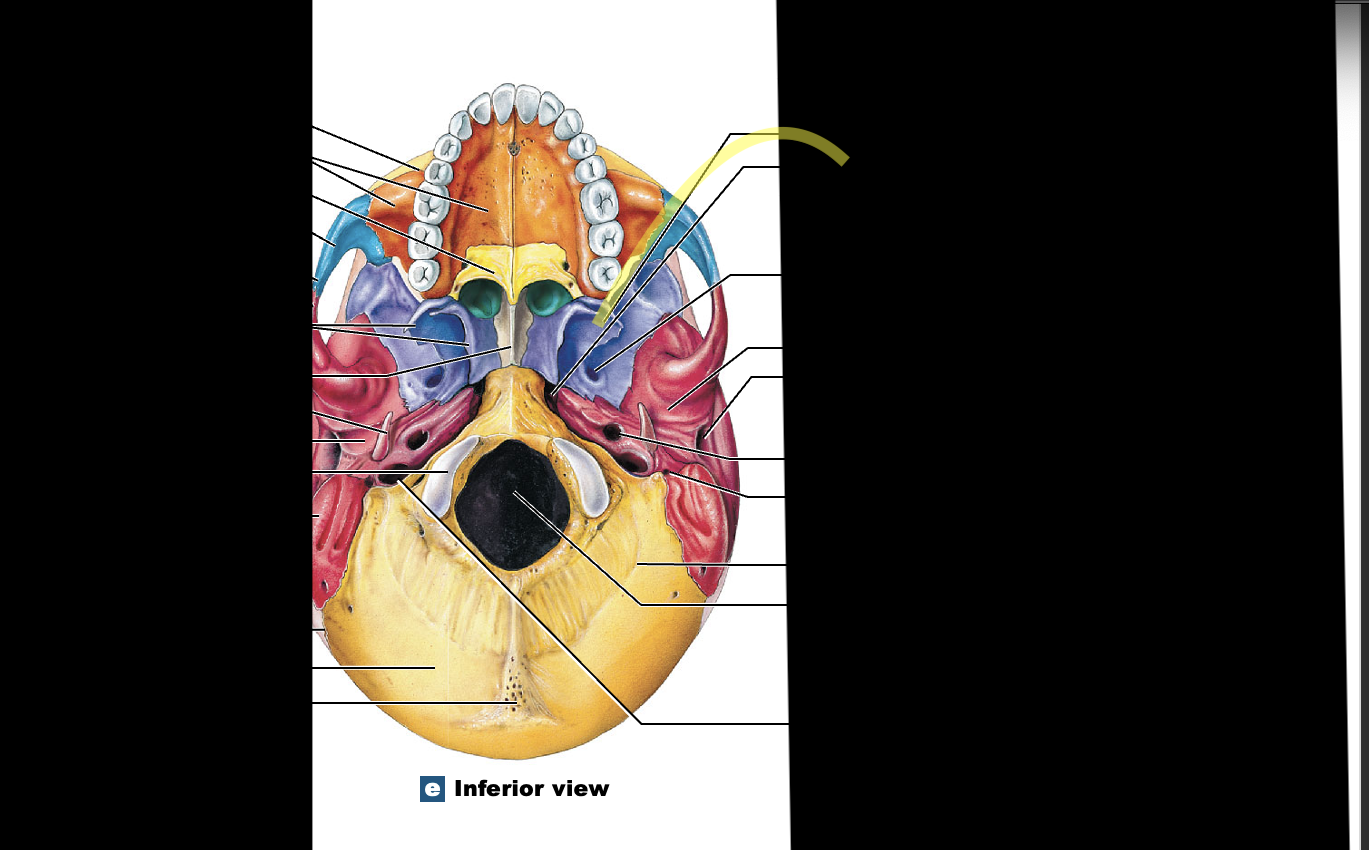 <p><strong>(1) </strong>Sphenoid; in front of temporal bone </p>