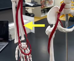 <p>Name the blood vessel.</p>