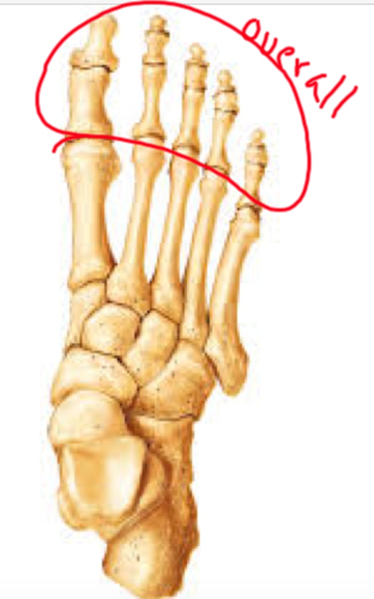 <p>ID bones</p>