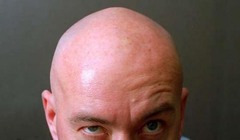 <p>bald</p>