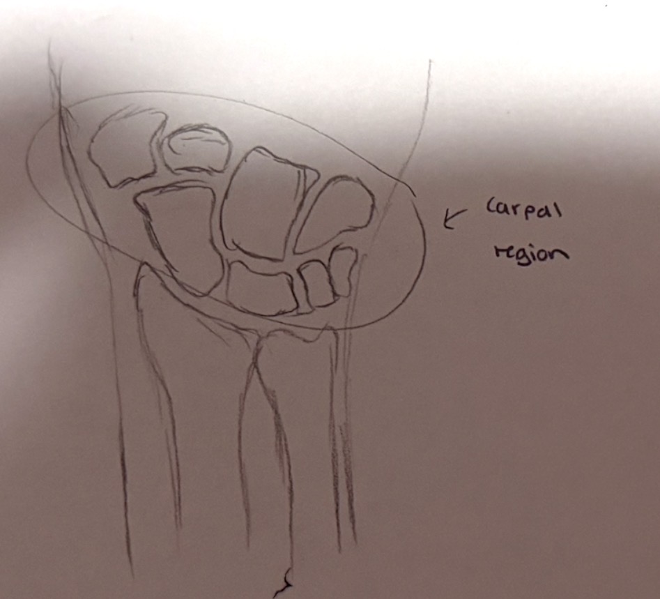 <p>wrist, specifically the eight small carpal bones that create the wrist</p>