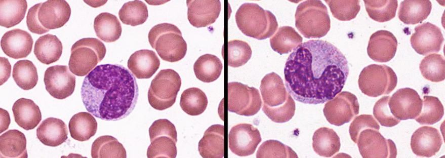 <p>largest leukocyte (double erythrocyte), lots of clear cytoplasm and a c-shaped nucleus</p>