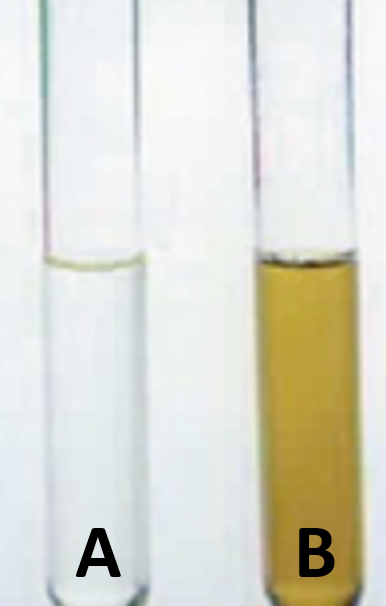 <p><span>Which of the urine samples shown in the image is likely to have a lower Urine Specific Gravity?</span></p>
