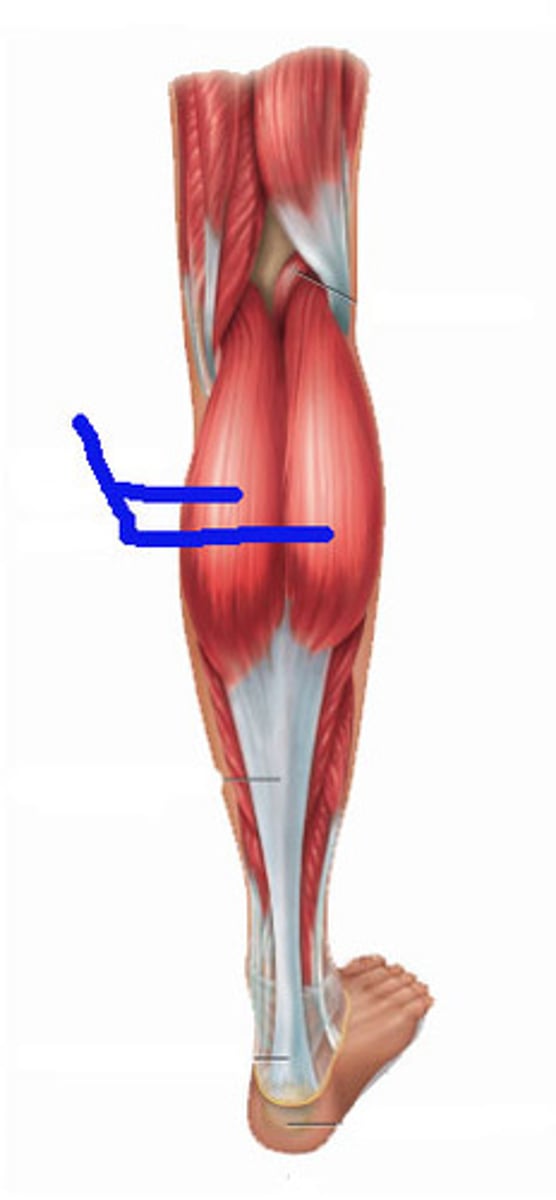 <p>Muscles that plantar flex the ankle; all innervated by the tibial nerve; divided into superficial and deep groups</p>
