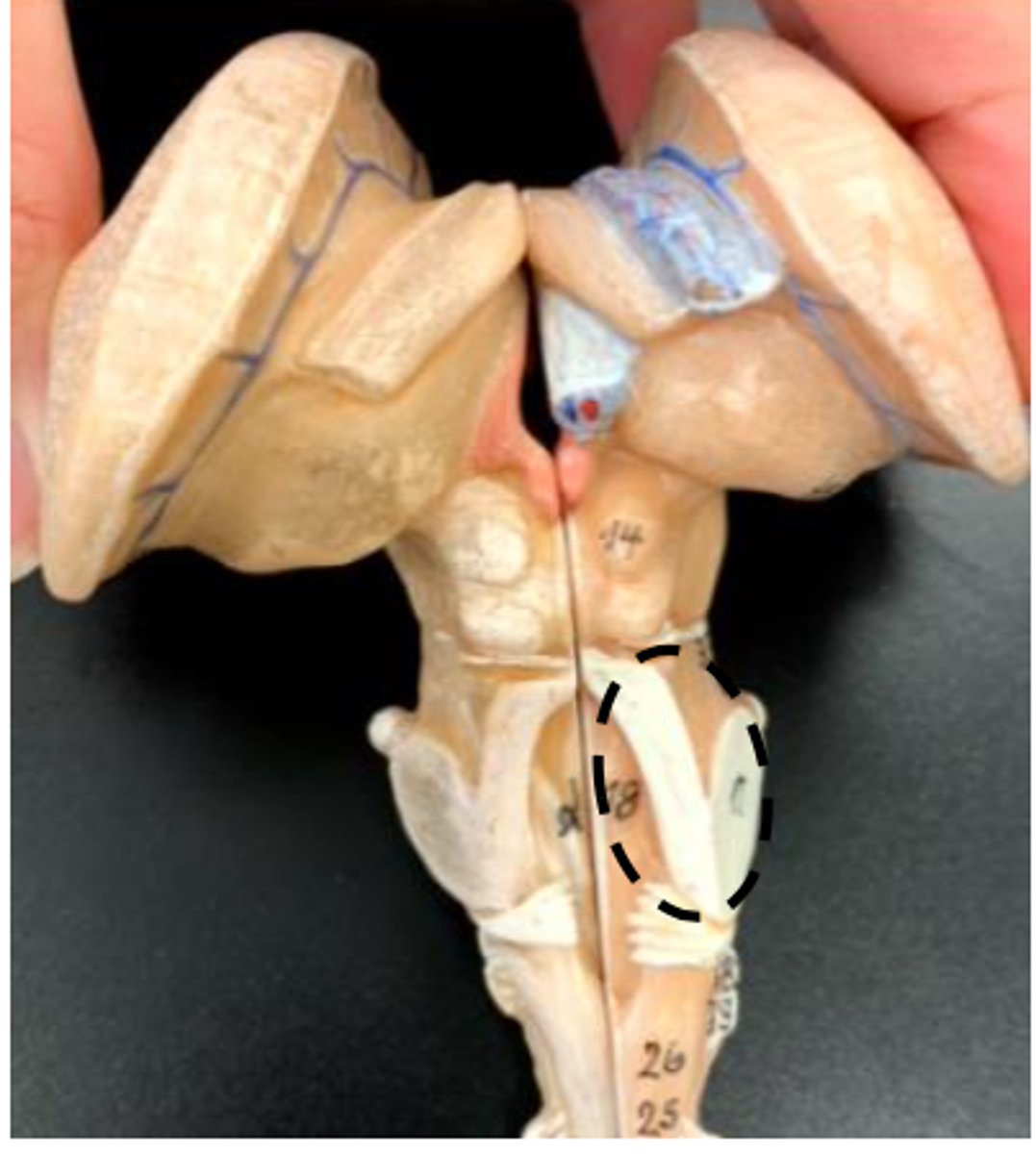 <p>brainstem view</p>