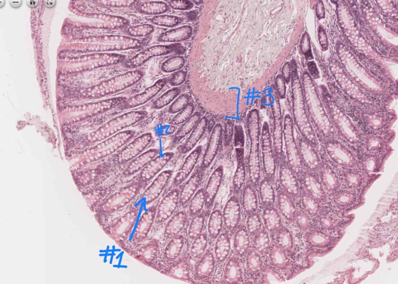 <p>What structure is # 1 referring to?</p>