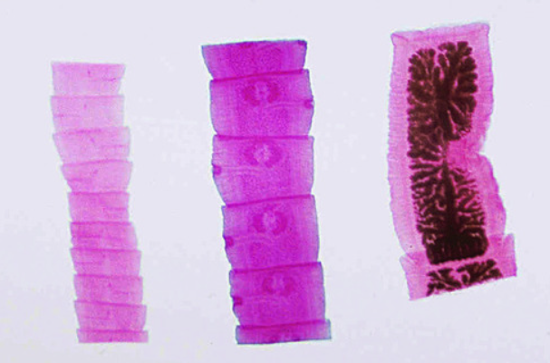 <p>what are the types of proglotiids of class cestoda?</p>