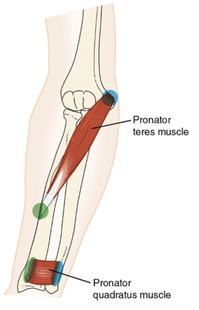 <p>What muscle is this?</p>