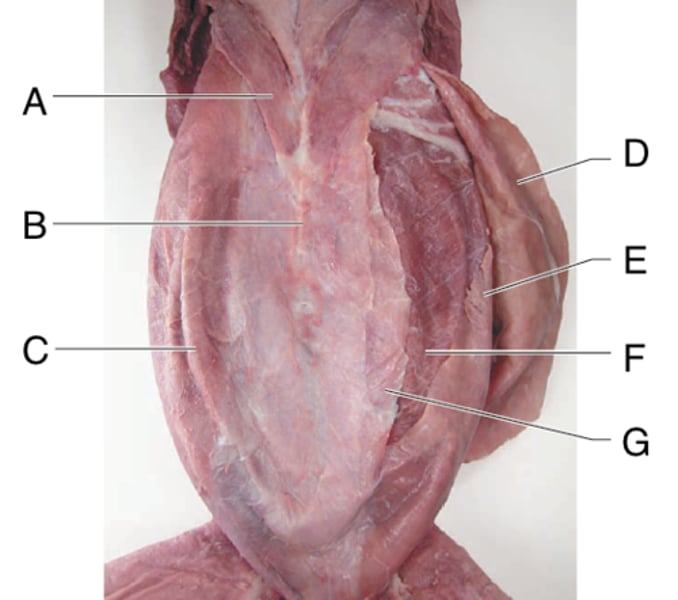 <p>What is the muscle indicated by letter G?</p>