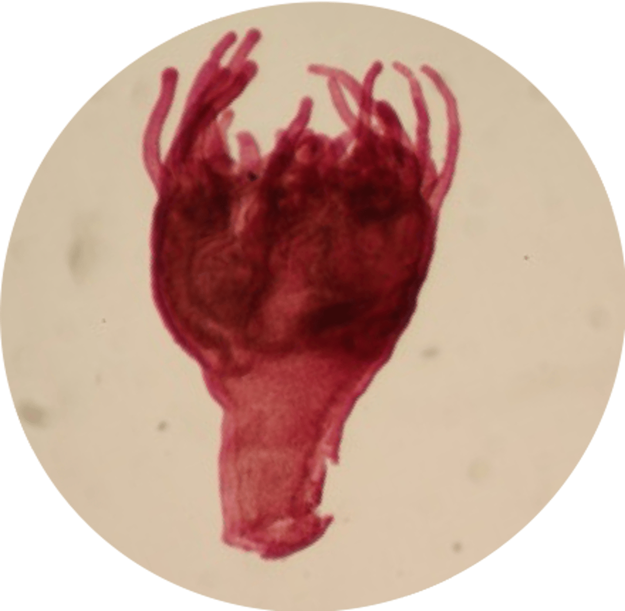 <p>Scyphistoma</p><p>(polyp)</p>