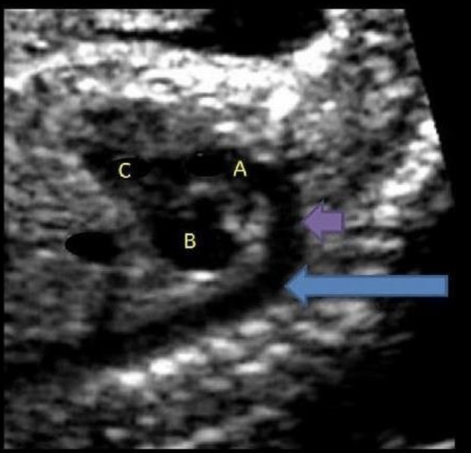 <p>letter C is what</p><p>a) left atrium</p><p>b) left ventricle</p><p>c) right atrium</p><p>d) right ventricle</p>